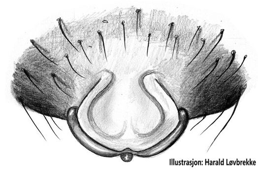 Datei:Improphantes decolor epigyn HLovbrekke.jpg