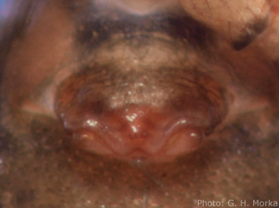 Datei:Agyneta mossica w epigyn Balteskard Troms 5.8.2010 GHMorka.jpg