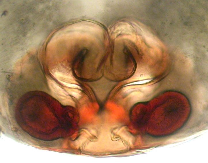 Datei:Micrargus subaequalis vulva trockenerSandboden Storesand 14.10.2010 AFjellberg.jpg