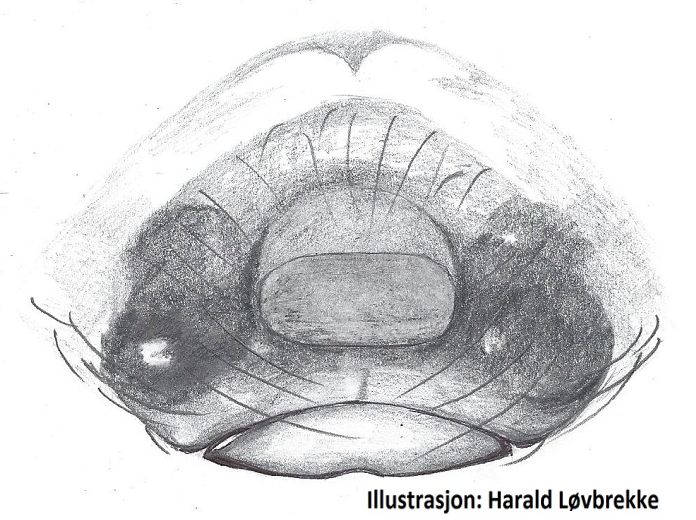 Datei:Silometopus reussi epigyn HLovbrekke.jpg
