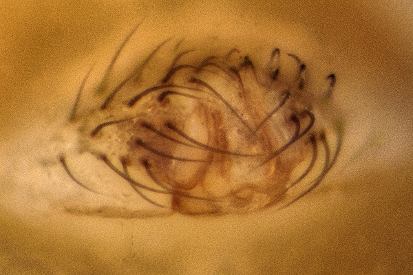 Datei:Palliduphantes ericaeus 18.10.2016-Herrnburg-MV Epigyne.jpg