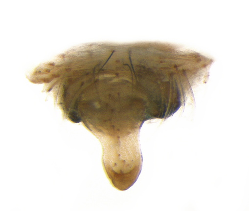 Datei:Araneus pallidus epigyne ve 18mm SaintAndre France 17Okt12 POger.jpg