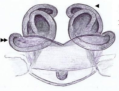 Datei:Porrhomma montanum VULVA HLoevbrekke.jpg