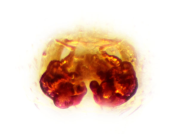 Datei:Bianor albobimaculatus Vulva P.jpg