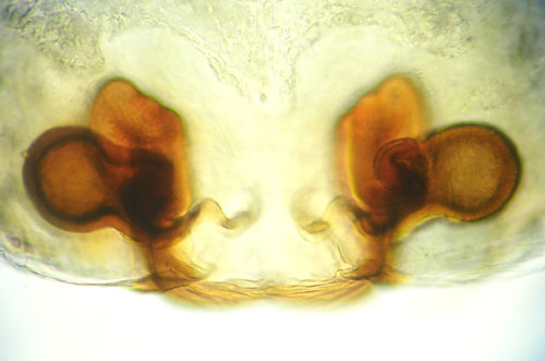 Datei:Oedothorax agrestis vulva Vegaar GHMorka.jpg