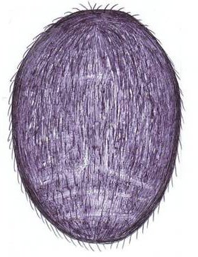 Datei:Agyneta decora m opisthosoma dorsal HLoevbrekke.jpg