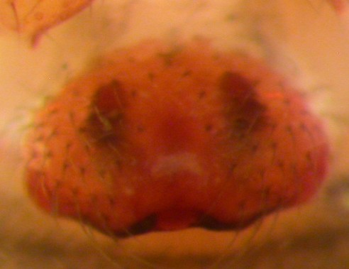 Datei:Tibioploides arcuatus w epigyn 2,2mm Elverum 2012.05.02 AFjellberg.jpg