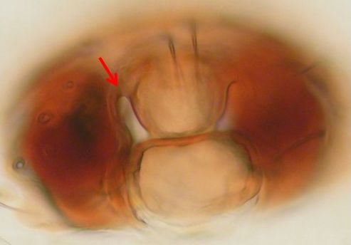 Datei:Scandichrestus tenuis w epigyn 1,4mm Bodenstreu 2000moh AFjellberg.jpg