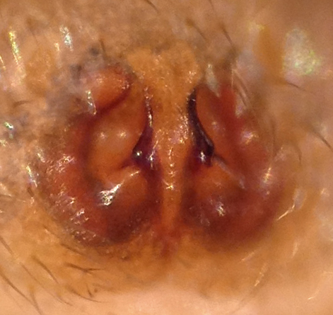 Datei:MicariaRossicaEpigyne.jpg