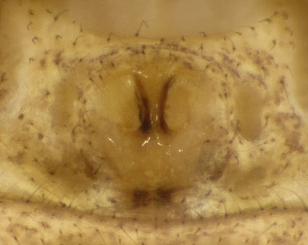 Datei:Xysticus-cristatus Ettersberg 09-06 02-Epig.jpg