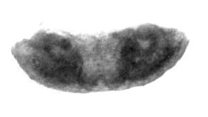 Datei:Diplocephalus permixtus Vulva.jpg