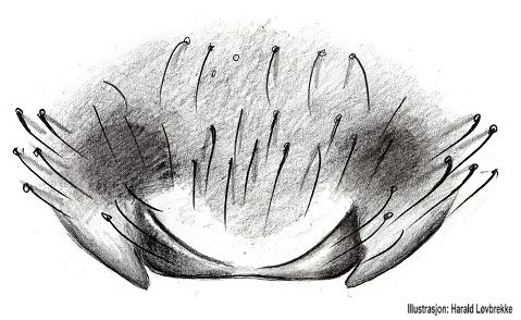 Datei:Tegenaria domestica epigyn HLovbrekke.jpg