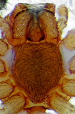 Datei:Nigma puella 2013-05-20 m Sternum.jpg