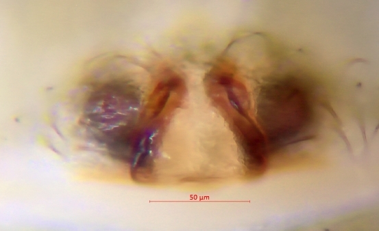 Datei:Oedothorax gibbosus-2014-06-21-Wesloer Moor-Epigyne-01.jpg