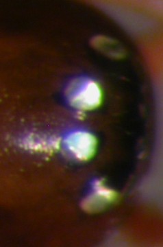 Datei:Thyreosthenius parasiticus w augen Jarlsbergparken 07.11.2010 AFjellberg.jpg