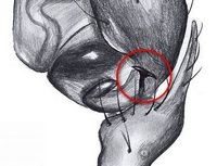 Trichopterna cito palp HLovbrekke-Ausschnitt.jpg