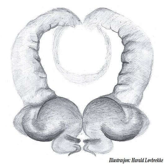 Datei:Ozyptila arctica vulva HLovbrekke.jpg
