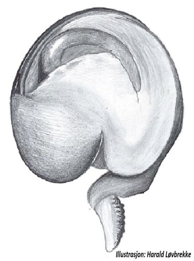 Datei:Brigittea latens palp underside HLovbrekke.jpg