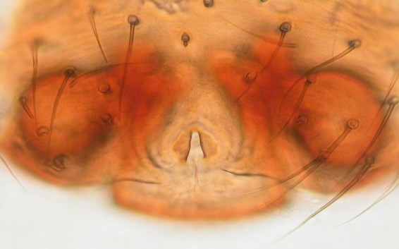 Datei:Troxochrota scabra hunn epigyn Stordalsberget 28.04.2012 AFjellberg.jpg
