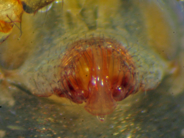 Datei:Lepthyphantes leprosus-Epigyne.jpg