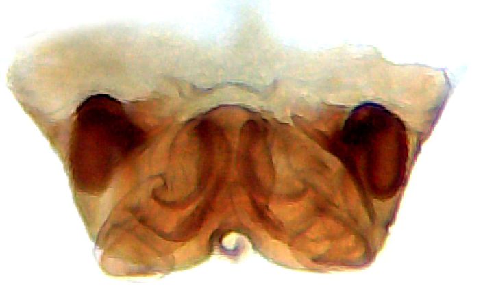 Datei:Meioneta saxatilis vulva GHMorka.jpg