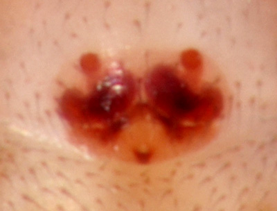 Datei:Porrhomma pallidum w epigyn 1,7mm GHMorka.jpg