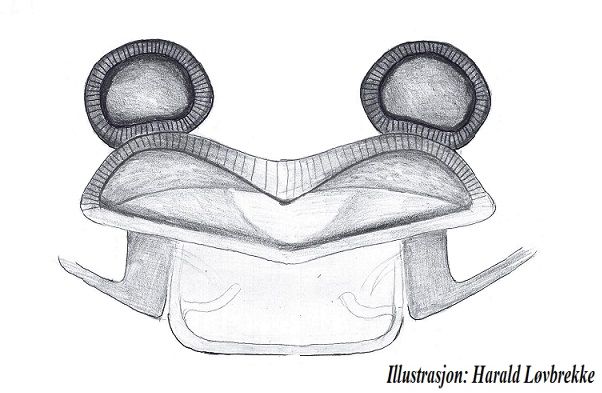 Datei:Gongylidiellum latebricola vulva dorsalt HLovbrekke.jpg