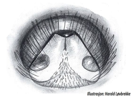 Datei:Arctosa perita epigyn HLovbrekke.jpg