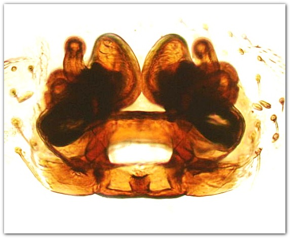 Datei:Porrhomma micropthalmum w vulva MFarlund.jpg