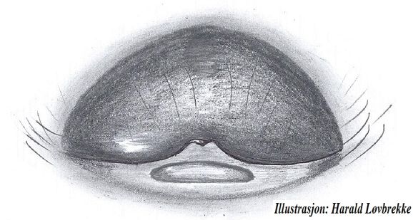 Datei:Hypselistes jacksoni epigyn HLovbrekke.jpg