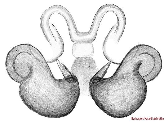 Datei:Ozyptila scabricula vulva do HLovbrekke.jpg