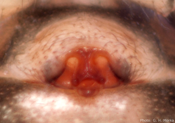 Datei:Agnyphantes expunctus epigyn GHMorka.jpg