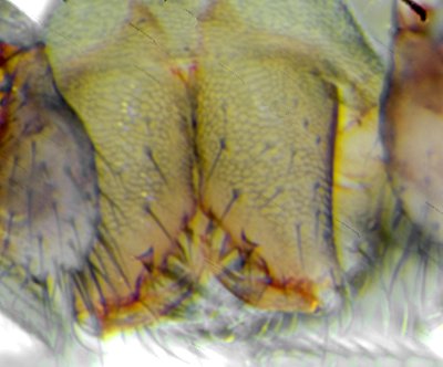 Datei:Gongylidiellum latebricola 15.06.13 m Chelizerenbezahnung.jpg