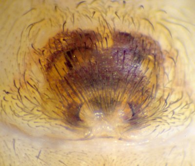 Datei:Clubiona lutescens epigyne (2)-20.05.10-481-8.jpg