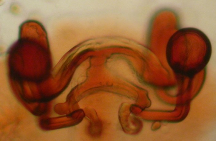 Datei:Pholcomma gibbum vulva Arne Fjellberg.jpg