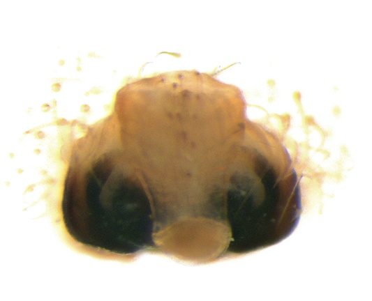 Datei:Araneus pallidus epigyne2 ve 18mm SaintAndre France 17Okt12 POger.jpg