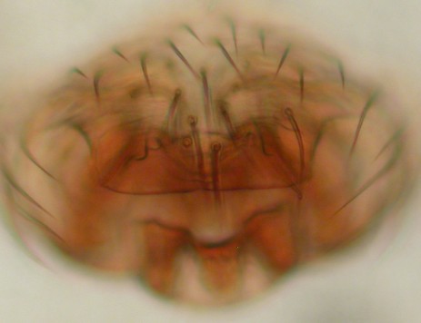Datei:Syedra apetlonensis w epigyne dorsal mikro 1,5mm Tjømekollen 31.05.2011 AFjellberg.jpg