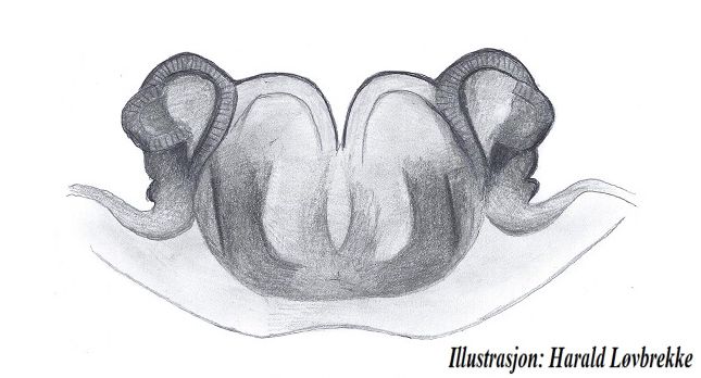 Datei:Aphileta misera vulva dorsalt HLovbrekke.jpg