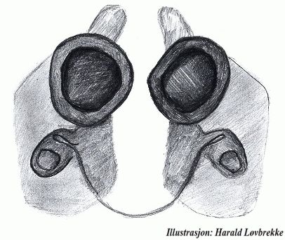 Datei:Araniella alpica vulva ventral HLovbrekke.jpg