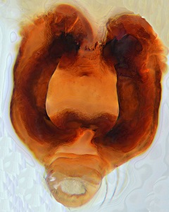 Datei:Araniella cucurbitina Vulva Causse mejean WOertel.jpg