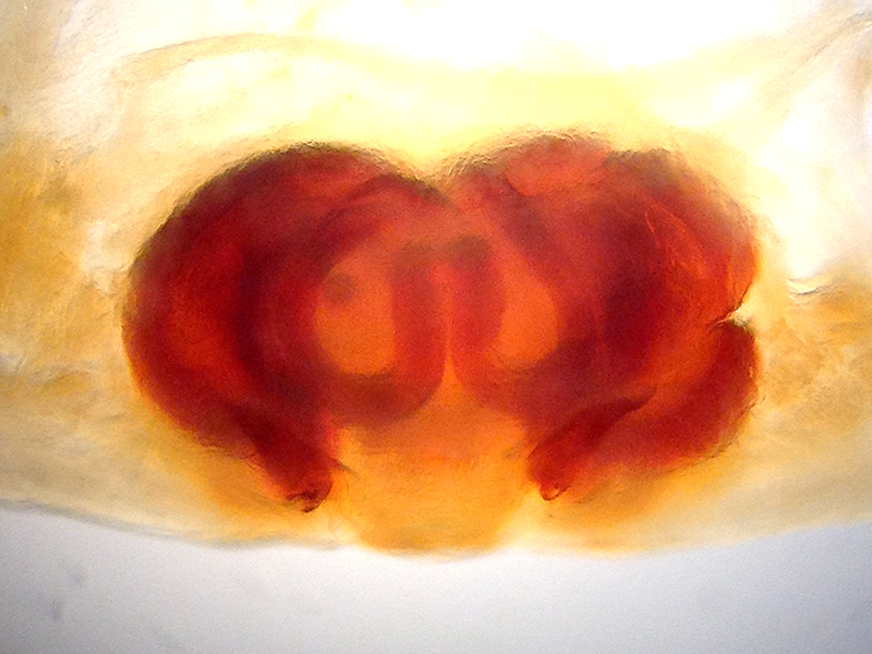 Datei:CheiracanthiumStriolatumEpigyneDorsal1.jpg