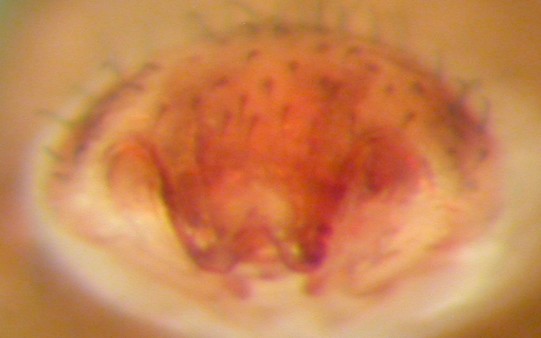 Datei:Agyneta olivacea epigyn Femunden Sumpf 07.03.2012 AFjellberg.jpg