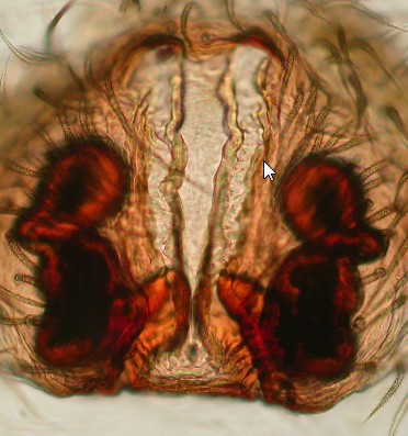 Datei:Pardosa schenkeli w vulva ve Vågå 13.063 AFjellberg.jpg