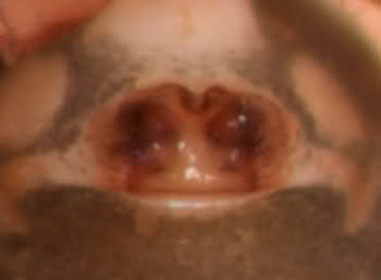 Datei:Thyreosthenius parasiticus w epigyn GHMorka.jpg