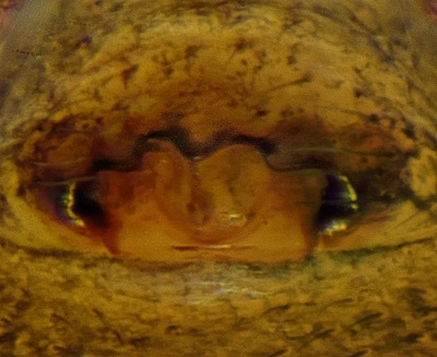 Datei:Gongylidiellum murcidum Moelln Grundloser Kolk 2014-07-19 Epigyne.jpg