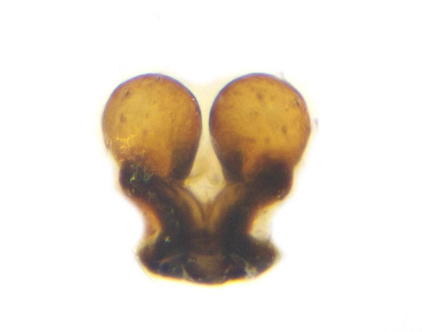 Datei:Enoplognatha thoracica female A5761 PM6960.jpg