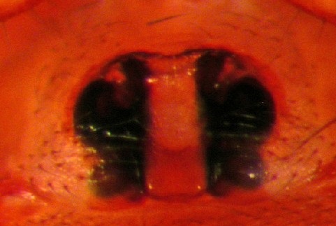 Datei:Gonatium rubellum epigyn Arne Fjellberg.jpg