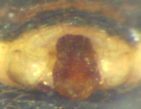 Datei:Mangora acalypha Epigyne.jpg