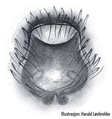 Datei:Civizelotes caucasius epigyn HLovbrekke.jpg