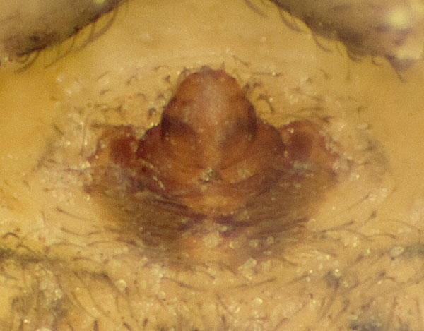 Datei:Ozyptila-claveata Schirnewitz 09-04 02-Epigyne.jpg